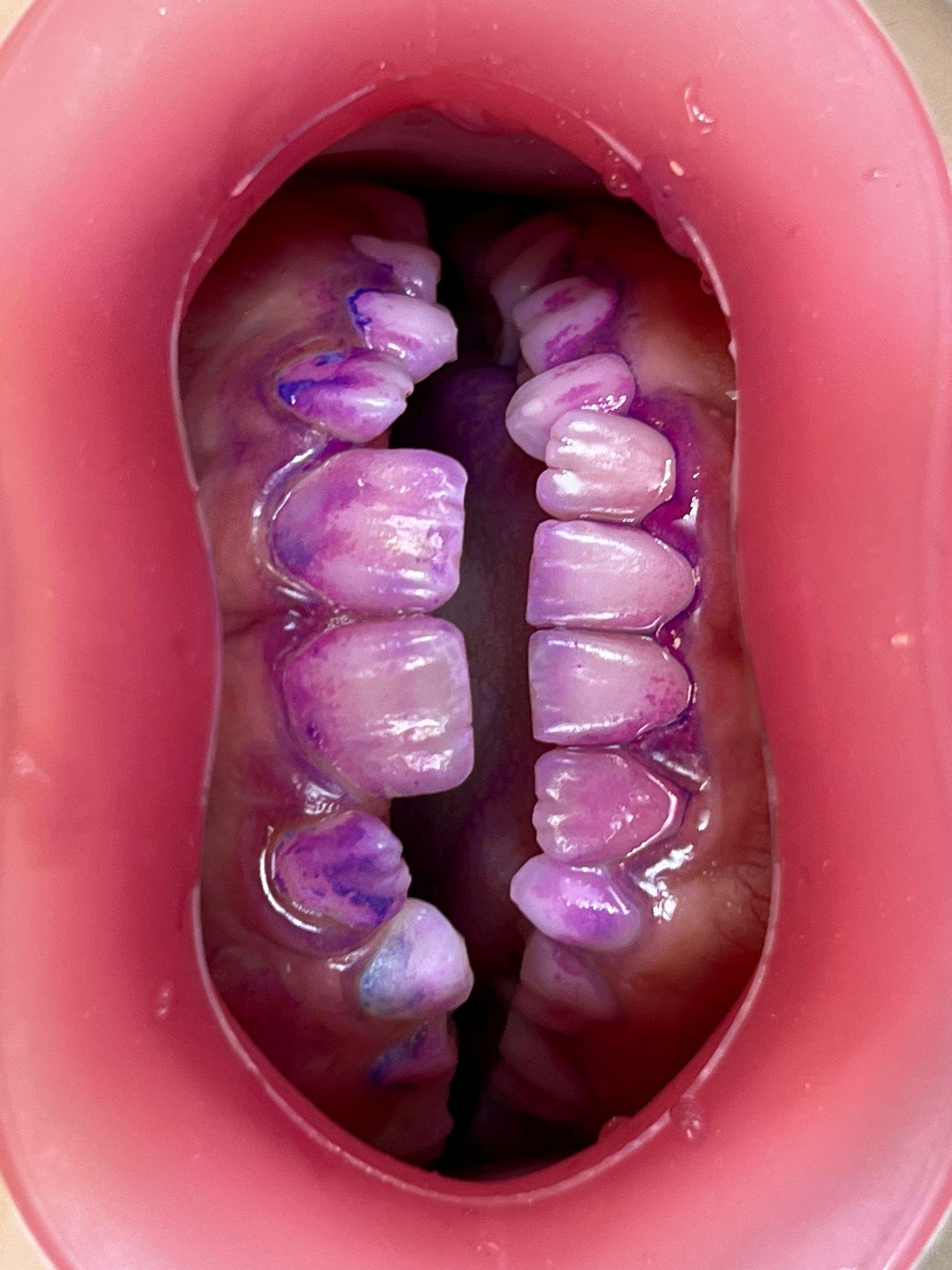 Intraorální dentální fotografie: praktický průvodce pro moderní ordinaci